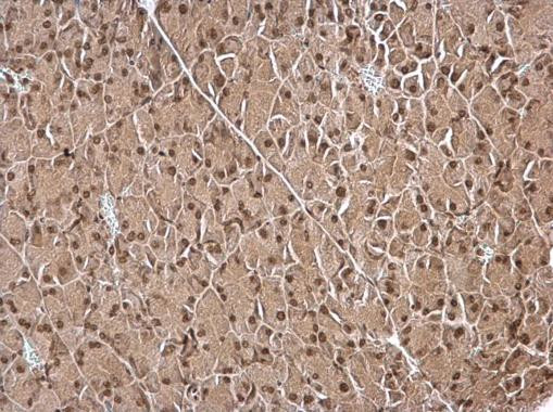 IPO5 Antibody in Immunohistochemistry (Paraffin) (IHC (P))