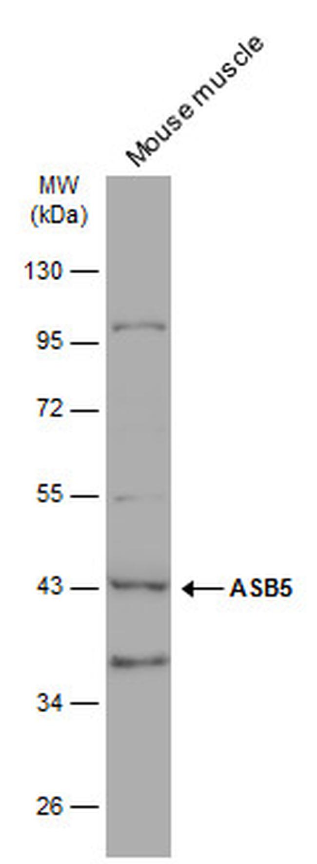 ASB5 Antibody in Western Blot (WB)