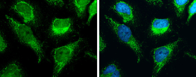 RBFA Antibody in Immunocytochemistry (ICC/IF)