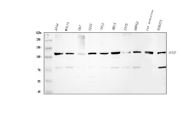 ATP Citrate Lyase Antibody in Western Blot (WB)