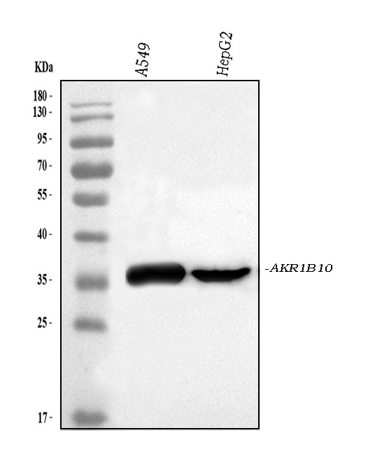 AKR1B10 Antibody in Western Blot (WB)