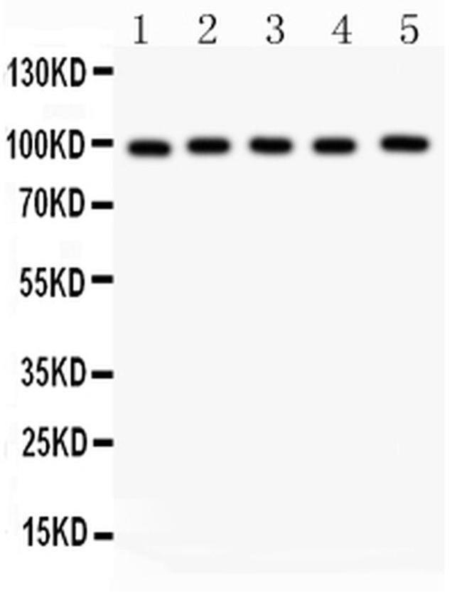 ASPH Antibody in Western Blot (WB)