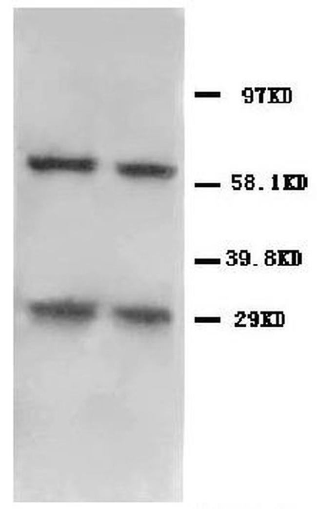BNIP3 Antibody in Western Blot (WB)