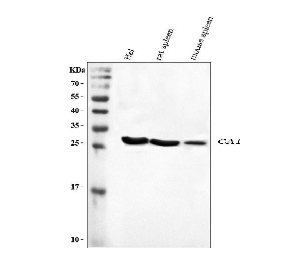 Carbonic Anhydrase I Antibody in Western Blot (WB)