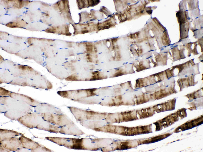 Carbonic Anhydrase III Antibody in Immunohistochemistry (Paraffin) (IHC (P))