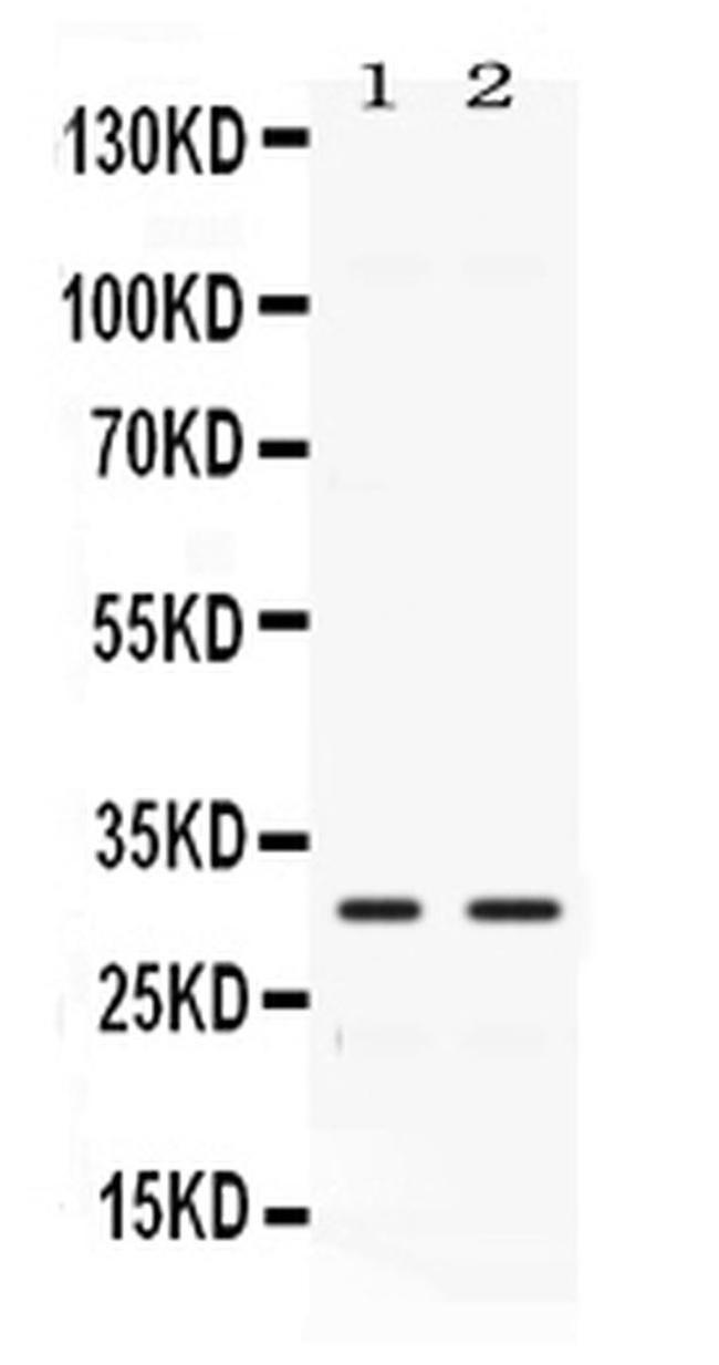 Carbonic Anhydrase III Antibody in Western Blot (WB)