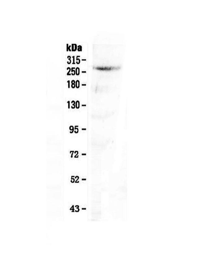 CAD Antibody in Western Blot (WB)