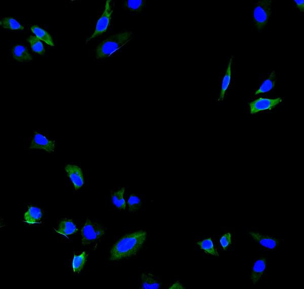 Calpain 2 Antibody in Immunocytochemistry (ICC/IF)