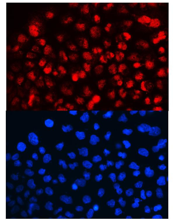 Cyclin T1 Antibody in Immunocytochemistry (ICC/IF)