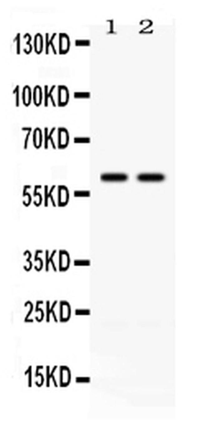 CCT3 Antibody in Western Blot (WB)
