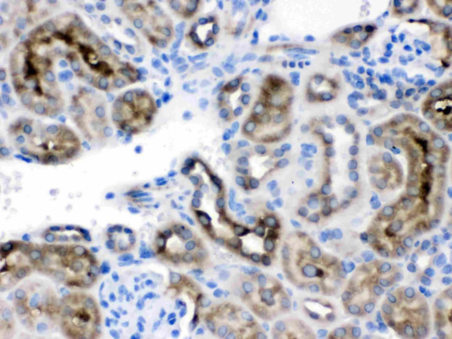 TCP-1 delta Antibody in Immunohistochemistry (Paraffin) (IHC (P))