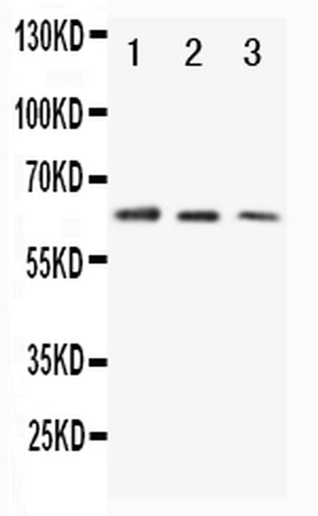 CD86 Antibody in Western Blot (WB)