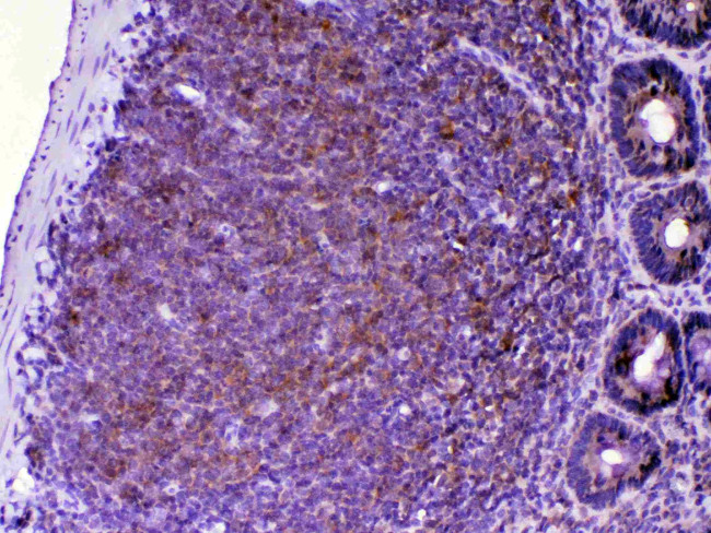 CTLA-4 (CD152) Antibody in Immunohistochemistry (Paraffin) (IHC (P))