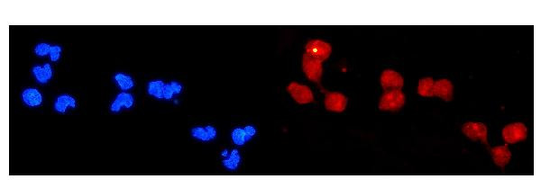 DDB2 Antibody in Immunocytochemistry (ICC/IF)