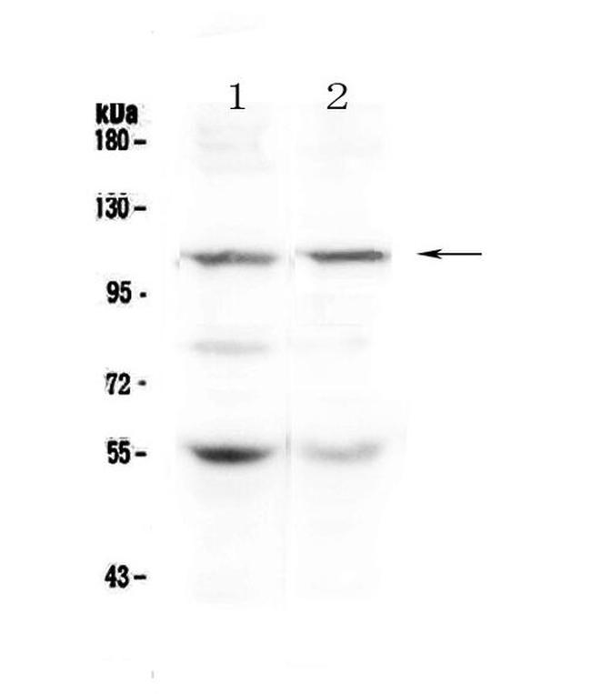 DPYD Antibody in Western Blot (WB)