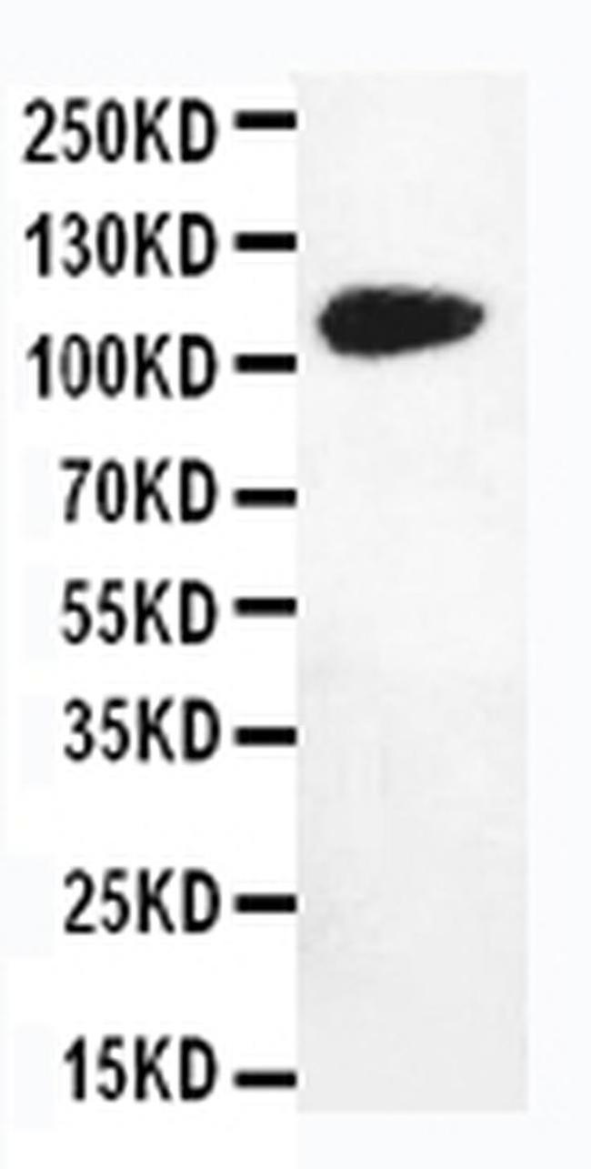 DPYD Antibody in Western Blot (WB)