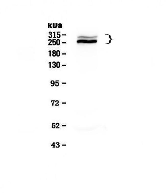 Desmoplakin Antibody in Western Blot (WB)