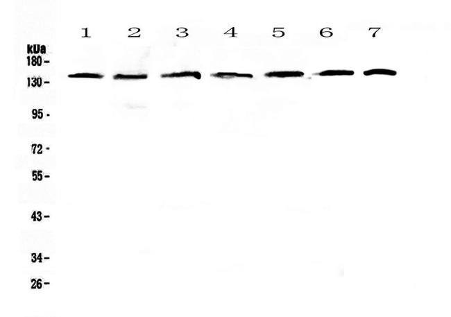 PERK Antibody in Western Blot (WB)