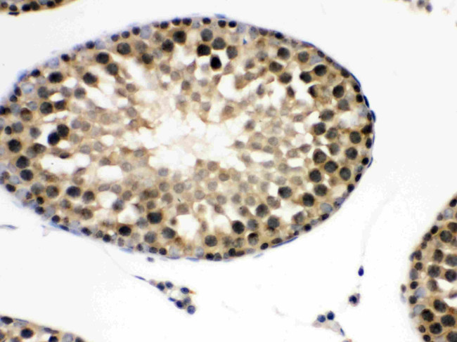 eIF6 Antibody in Immunohistochemistry (Paraffin) (IHC (P))