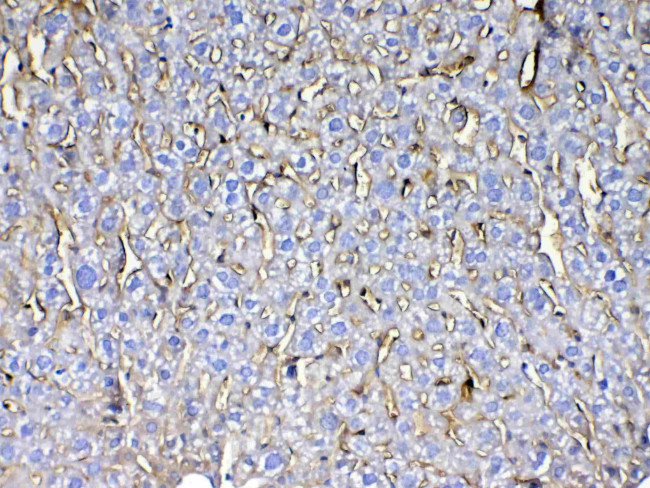 CD105 (Endoglin) Antibody in Immunohistochemistry (Paraffin) (IHC (P))