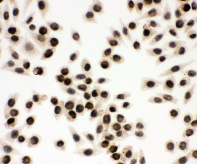 EWSR1 Antibody in Immunocytochemistry (ICC/IF)