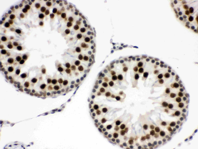 EWSR1 Antibody in Immunohistochemistry (Paraffin) (IHC (P))