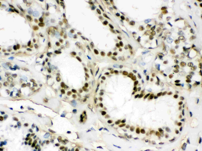 EWSR1 Antibody in Immunohistochemistry (Paraffin) (IHC (P))