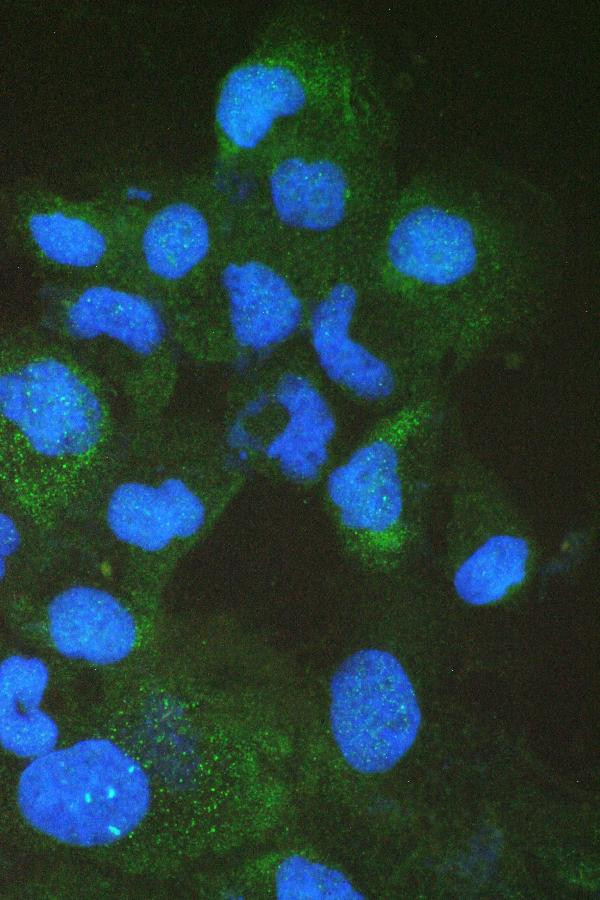 FABP2 Antibody in Immunocytochemistry (ICC/IF)