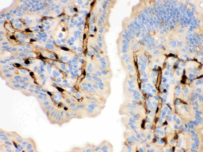 FABP4 Antibody in Immunohistochemistry (Paraffin) (IHC (P))