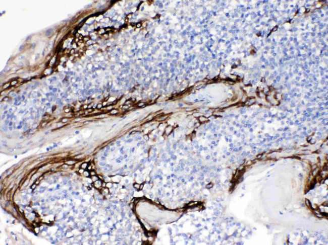 FDCSP Antibody in Immunohistochemistry (Paraffin) (IHC (P))