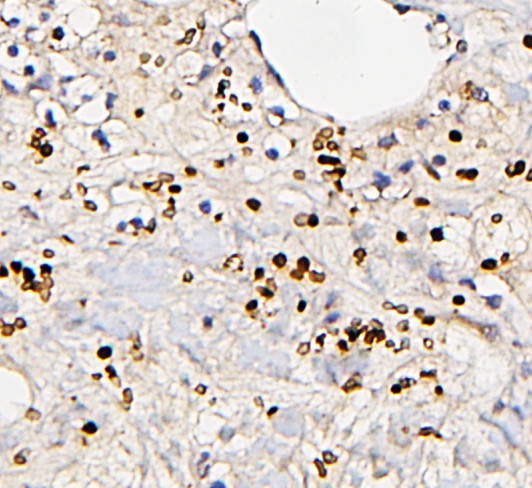 FosB Antibody in Immunohistochemistry (Paraffin) (IHC (P))