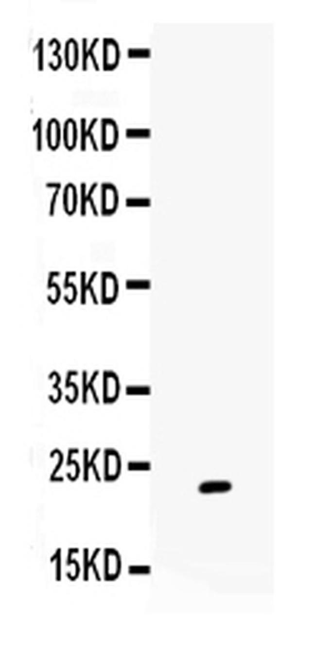 GREM1 Antibody in Western Blot (WB)