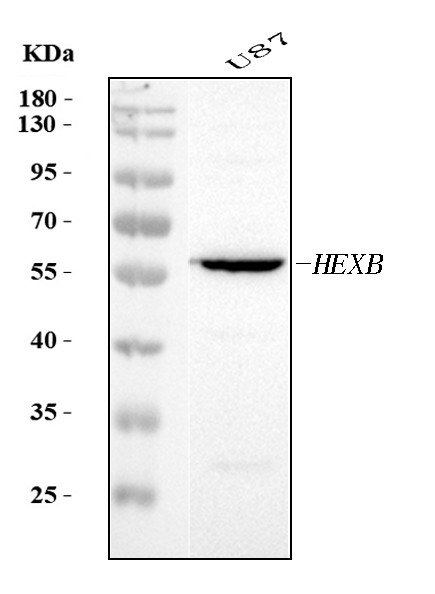 HEXB Antibody in Western Blot (WB)