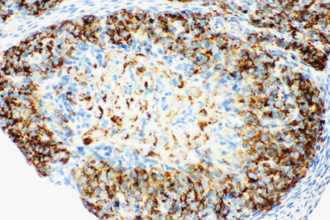 HSD17B1 Antibody in Immunohistochemistry (Paraffin) (IHC (P))