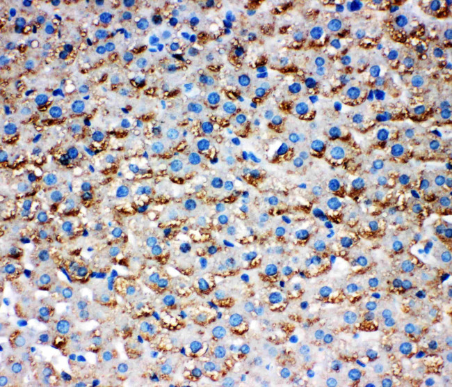 HSD17B1 Antibody in Immunohistochemistry (Paraffin) (IHC (P))