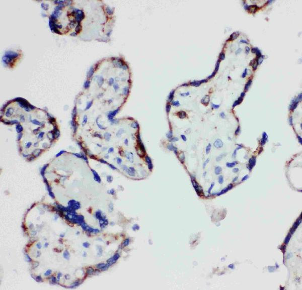 HSD17B1 Antibody in Immunohistochemistry (Paraffin) (IHC (P))