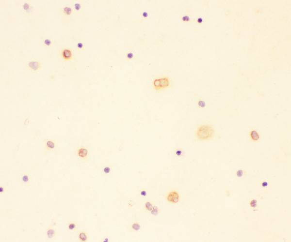 IL-18 Antibody in Immunocytochemistry (ICC/IF)