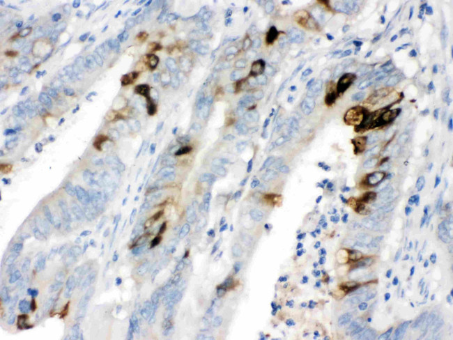 ITLN1 Antibody in Immunohistochemistry (Paraffin) (IHC (P))