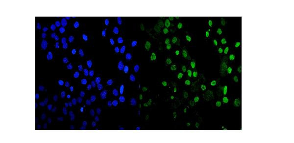 MDC1 Antibody in Immunocytochemistry (ICC/IF)