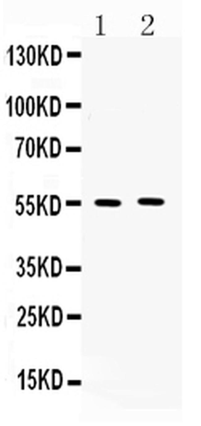 MMP11 Antibody in Western Blot (WB)