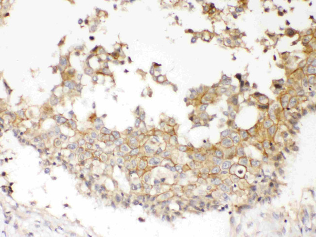 NDRG3 Antibody in Immunohistochemistry (Paraffin) (IHC (P))