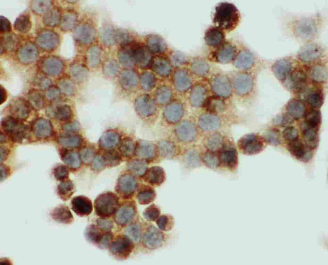 HNF6 Antibody in Immunocytochemistry (ICC/IF)