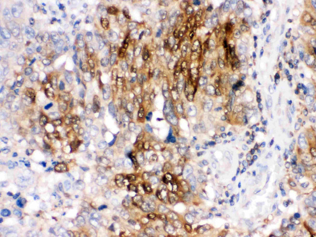 DARPP-32 Antibody in Immunohistochemistry (Paraffin) (IHC (P))