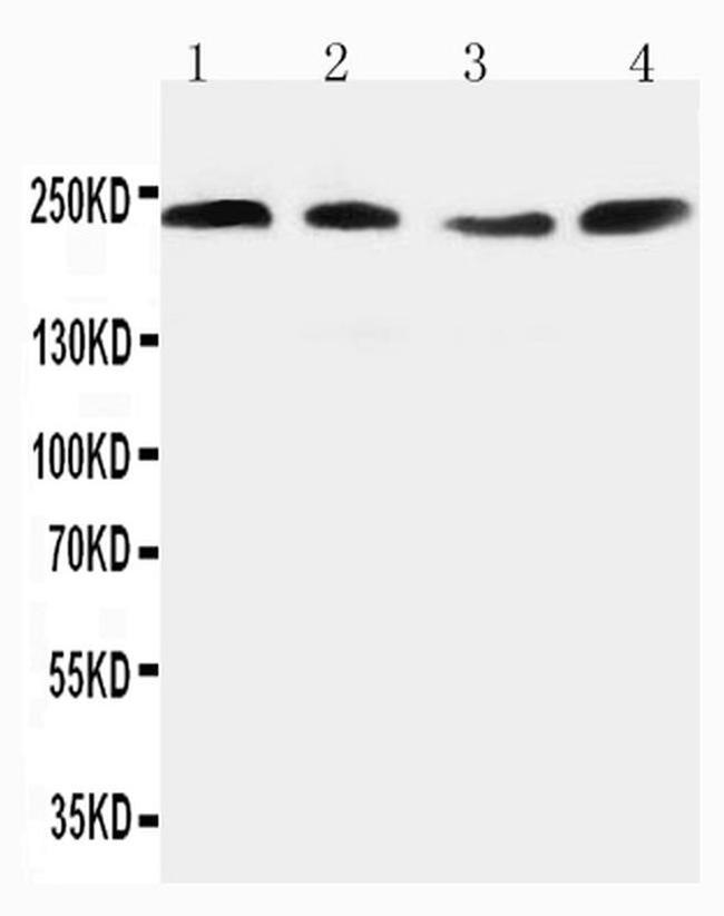 Nogo-A Antibody in Western Blot (WB)