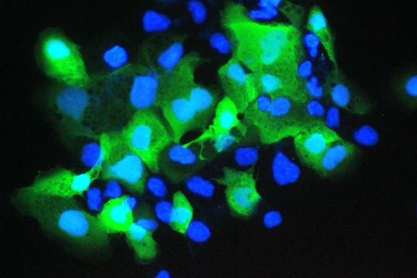 S100A7 Antibody in Immunocytochemistry (ICC/IF)