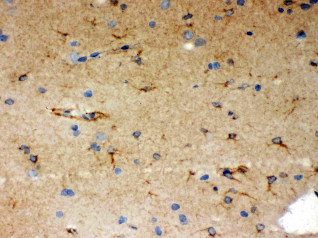 SHC Antibody in Immunohistochemistry (Paraffin) (IHC (P))