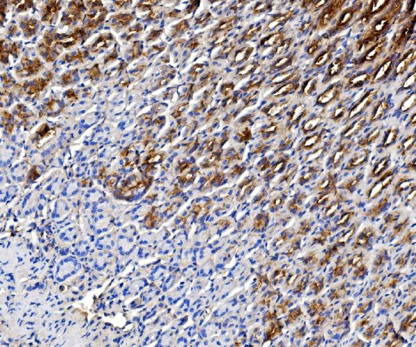 TFF1 Antibody in Immunohistochemistry (Paraffin) (IHC (P))