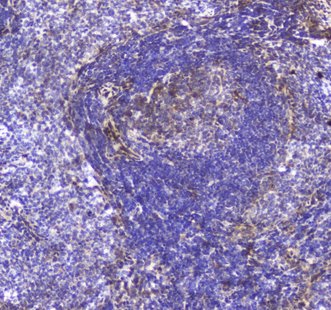 TLR1 Antibody in Immunohistochemistry (Paraffin) (IHC (P))