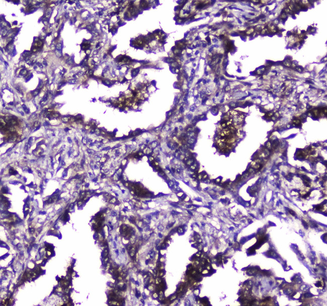 TLR1 Antibody in Immunohistochemistry (Paraffin) (IHC (P))