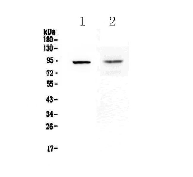 TLR1 Antibody in Western Blot (WB)